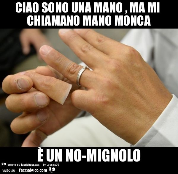 Ciao sono una mano , ma mi chiamano mano monca è un no-mignolo