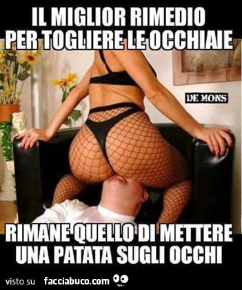 Il miglior rimedio per togliere le occhiaie rimane quello di mettere una patata sugli occhi