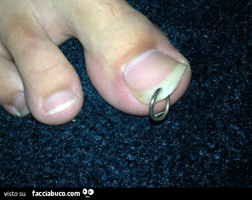 Piercing sull'unghia dell'alluce
